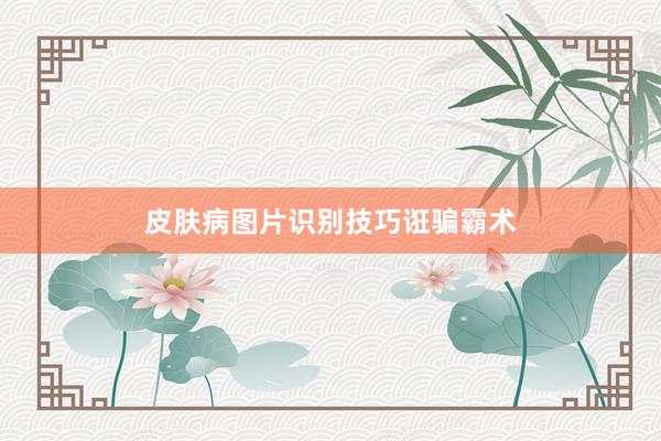皮肤病图片识别技巧诳骗霸术